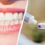 Med eller uden fluor: tandlægen svarede klart på, hvilken pasta